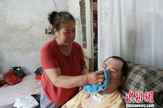 每次喂完食物后,梁青蘭都要仔細地幫兒子清理干凈。 尚明俠 攝