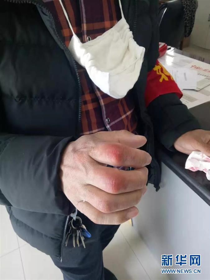 (在習近平新時代中國特色社會主義思想指引下——新時代新作為新篇章·習近平總書記關切事·圖文互動)(2)戰“疫”中的“凡人微光”